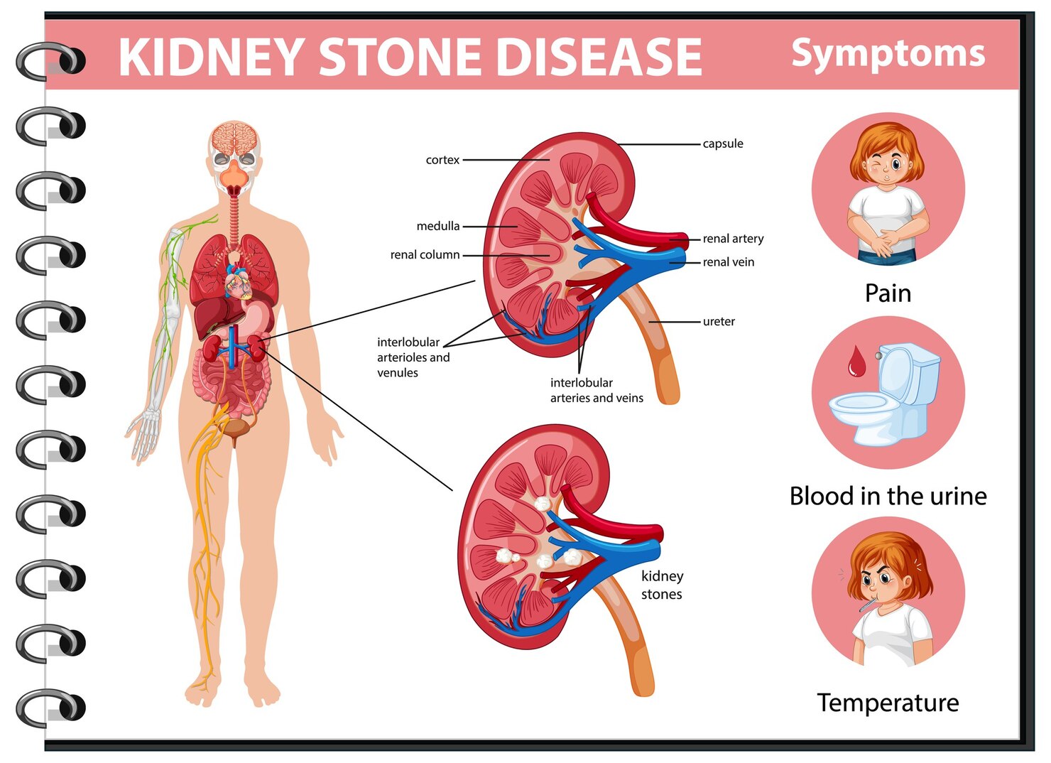 Kidney Disease Causes