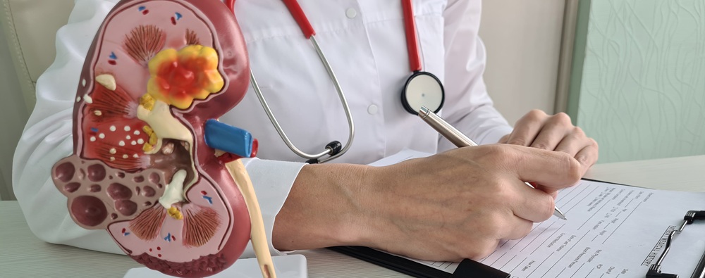 Kidney disease model showing inflammation and damage explained by Dr Raghavendra Pradeep for better diagnosis and treatment