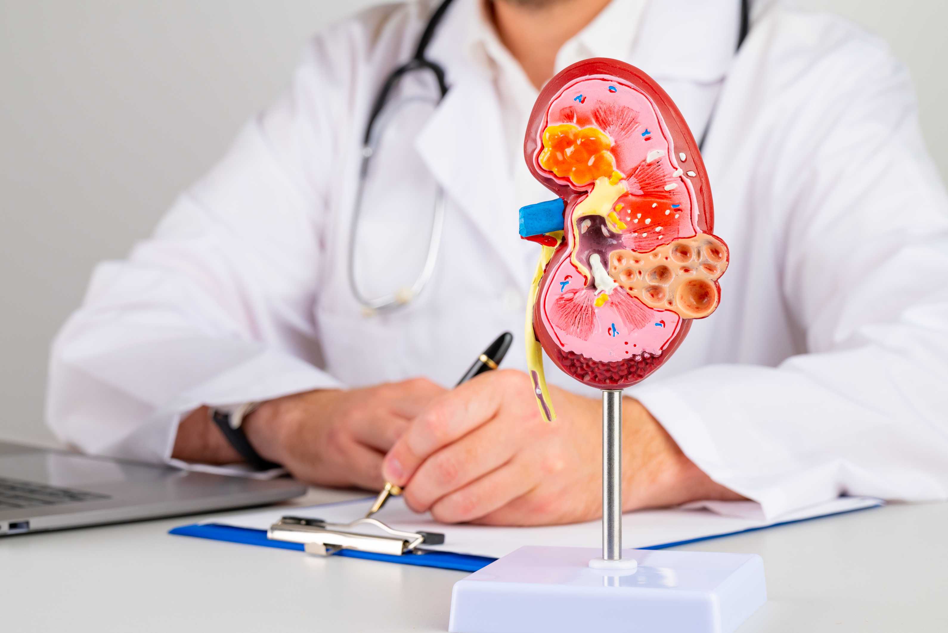 Understanding Kidney Disease